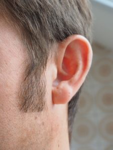 Jak odetkać ucho?