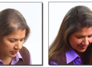 Zalety klamerkowej metody zagęszczania włosów