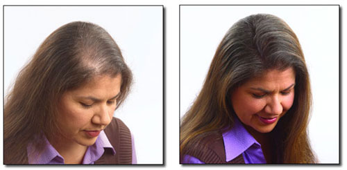 Zalety klamerkowej metody zagęszczania włosów